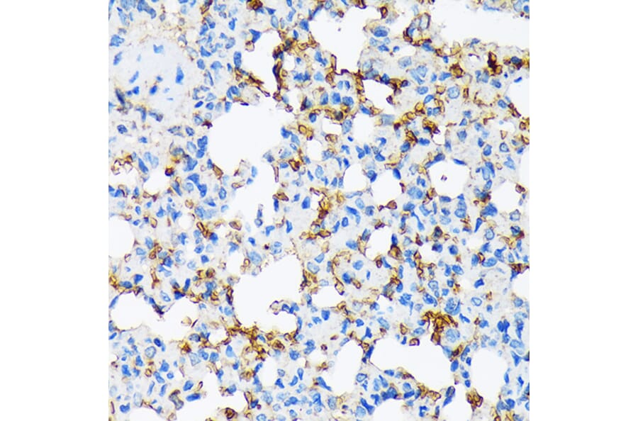Immunohistochemistry - Anti-alpha 2 Macroglobulin Antibody [ARC1734] (A308286) - Antibodies.com