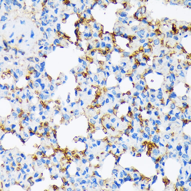 Immunohistochemistry - Anti-alpha 2 Macroglobulin Antibody [ARC1734] (A308286) - Antibodies.com