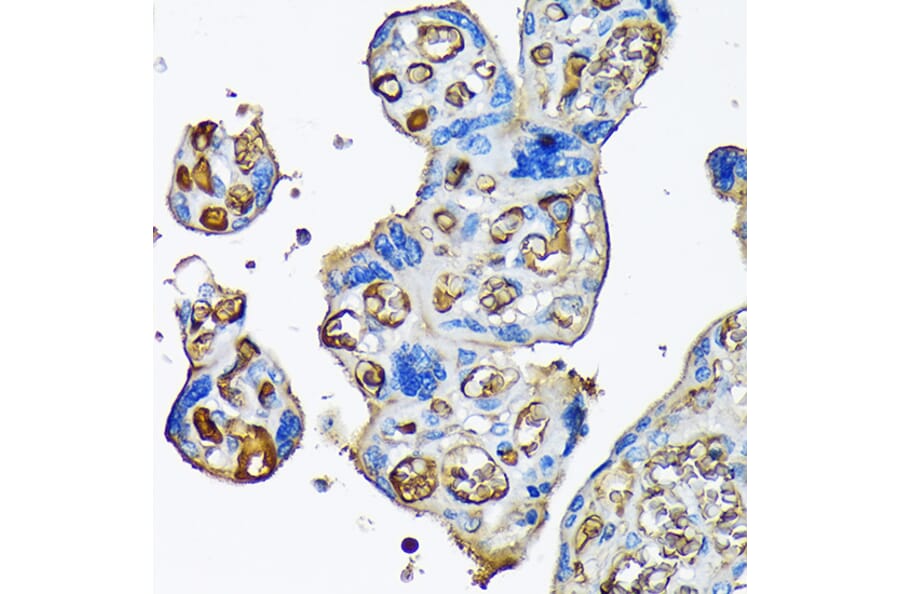 Immunohistochemistry - Anti-alpha 2 Macroglobulin Antibody [ARC1734] (A308286) - Antibodies.com