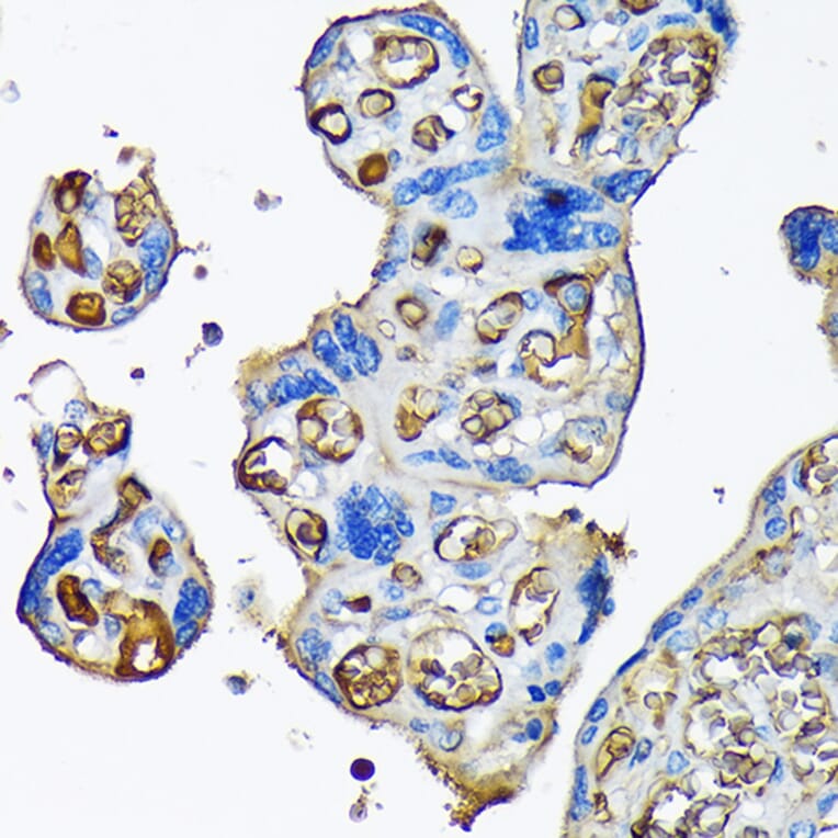 Immunohistochemistry - Anti-alpha 2 Macroglobulin Antibody [ARC1734] (A308286) - Antibodies.com