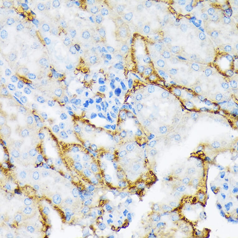 Immunohistochemistry - Anti-alpha 2 Macroglobulin Antibody [ARC1734] (A308286) - Antibodies.com