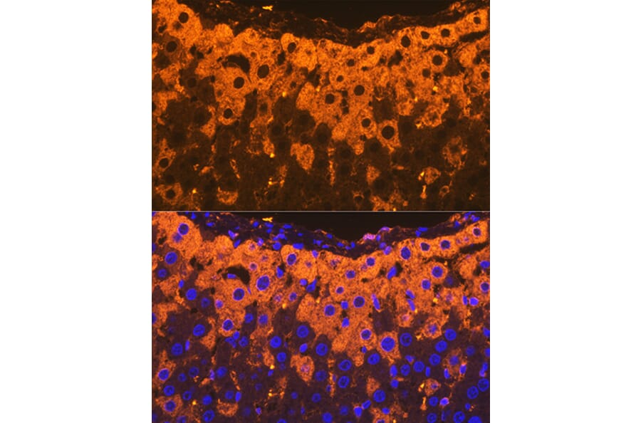 Immunofluorescence - Anti-alpha 2 Macroglobulin Antibody [ARC1734] (A308286) - Antibodies.com