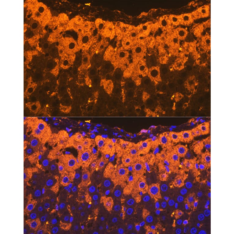 Immunofluorescence - Anti-alpha 2 Macroglobulin Antibody [ARC1734] (A308286) - Antibodies.com