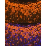 Immunofluorescence - Anti-alpha 2 Macroglobulin Antibody [ARC1734] (A308286) - Antibodies.com