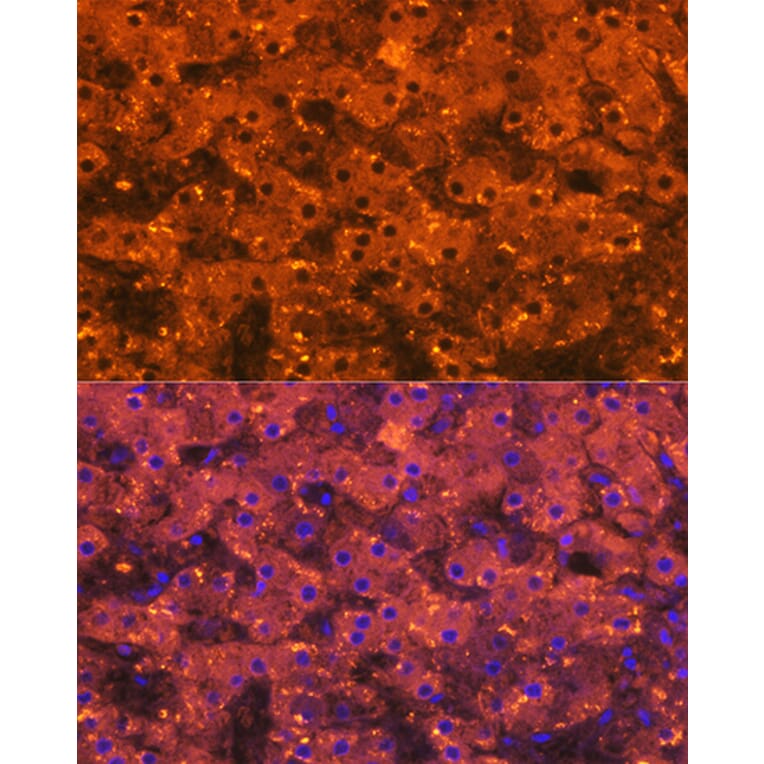 Immunofluorescence - Anti-alpha 2 Macroglobulin Antibody [ARC1734] (A308286) - Antibodies.com
