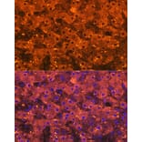 Immunofluorescence - Anti-alpha 2 Macroglobulin Antibody [ARC1734] (A308286) - Antibodies.com