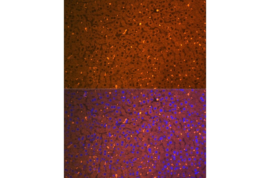 Immunofluorescence - Anti-alpha 2 Macroglobulin Antibody [ARC1734] (A308286) - Antibodies.com