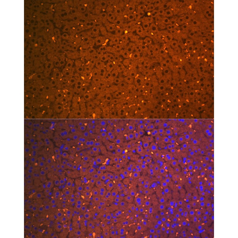 Immunofluorescence - Anti-alpha 2 Macroglobulin Antibody [ARC1734] (A308286) - Antibodies.com