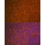 Immunofluorescence - Anti-alpha 2 Macroglobulin Antibody [ARC1734] (A308286) - Antibodies.com