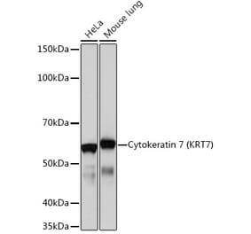 Western Blot - Anti-Cytokeratin 7 Antibody [ARC0978] (A308287) - Antibodies.com