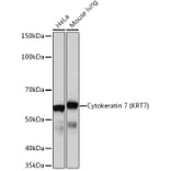 Western Blot - Anti-Cytokeratin 7 Antibody [ARC0978] (A308287) - Antibodies.com