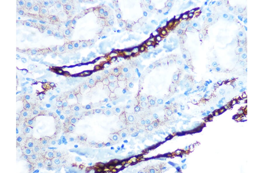 Immunohistochemistry - Anti-Cytokeratin 7 Antibody [ARC0978] (A308287) - Antibodies.com