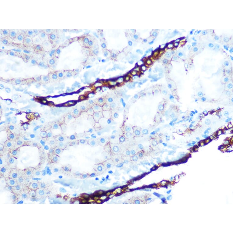 Immunohistochemistry - Anti-Cytokeratin 7 Antibody [ARC0978] (A308287) - Antibodies.com