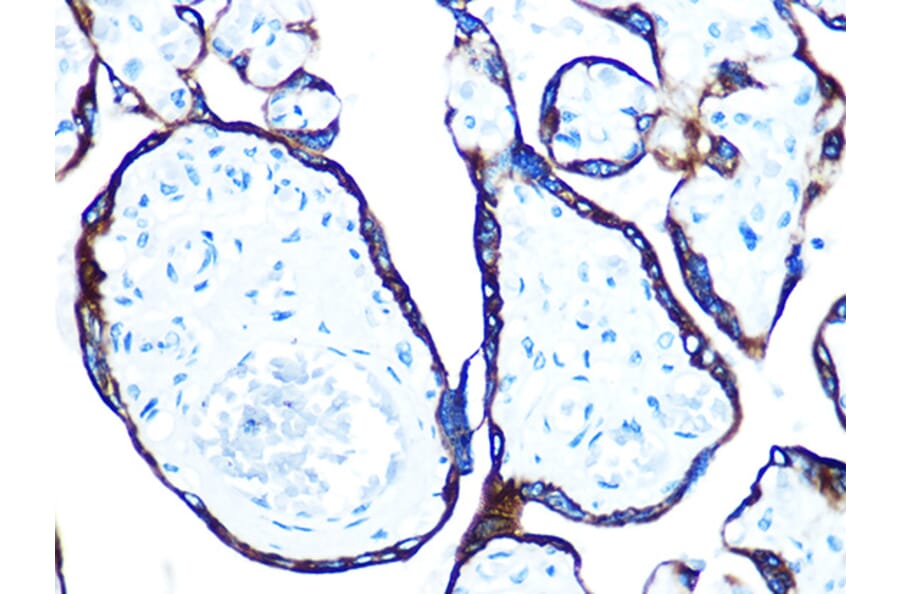 Immunohistochemistry - Anti-Cytokeratin 7 Antibody [ARC0978] (A308287) - Antibodies.com