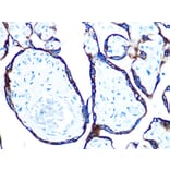 Immunohistochemistry - Anti-Cytokeratin 7 Antibody [ARC0978] (A308287) - Antibodies.com