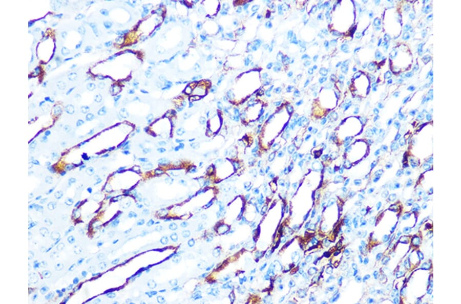 Immunohistochemistry - Anti-Cytokeratin 7 Antibody [ARC0978] (A308287) - Antibodies.com