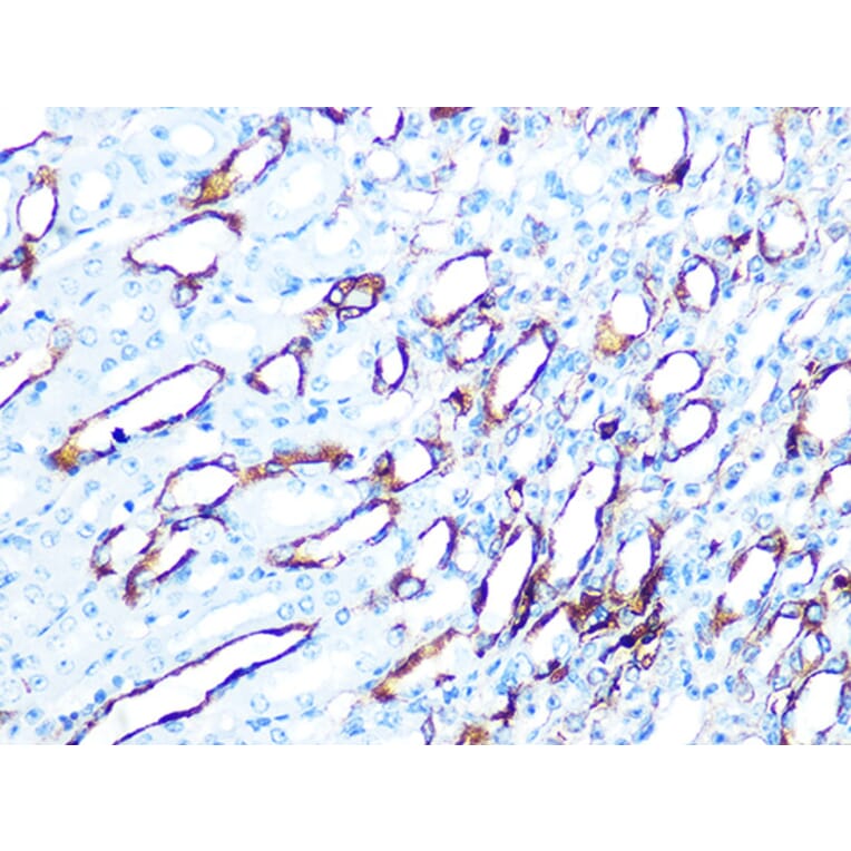 Immunohistochemistry - Anti-Cytokeratin 7 Antibody [ARC0978] (A308287) - Antibodies.com