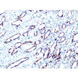 Immunohistochemistry - Anti-Cytokeratin 7 Antibody [ARC0978] (A308287) - Antibodies.com