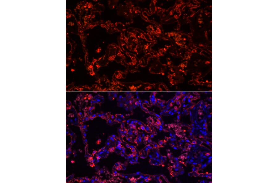 Immunofluorescence - Anti-Cytokeratin 7 Antibody [ARC0978] (A308287) - Antibodies.com