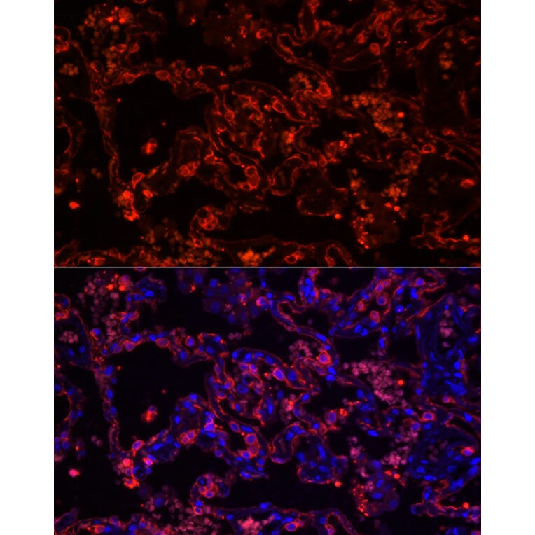 Immunofluorescence - Anti-Cytokeratin 7 Antibody [ARC0978] (A308287) - Antibodies.com