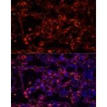 Immunofluorescence - Anti-Cytokeratin 7 Antibody [ARC0978] (A308287) - Antibodies.com