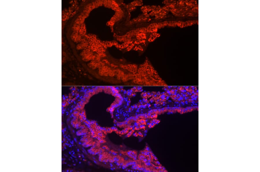 Immunofluorescence - Anti-Cytokeratin 7 Antibody [ARC0978] (A308287) - Antibodies.com