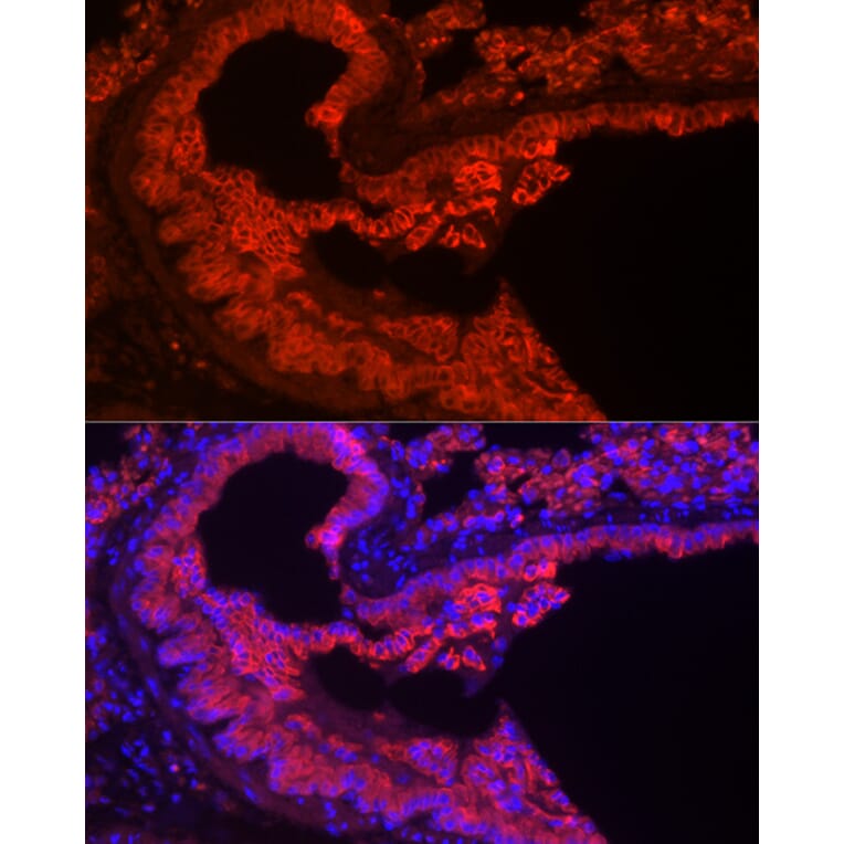 Immunofluorescence - Anti-Cytokeratin 7 Antibody [ARC0978] (A308287) - Antibodies.com