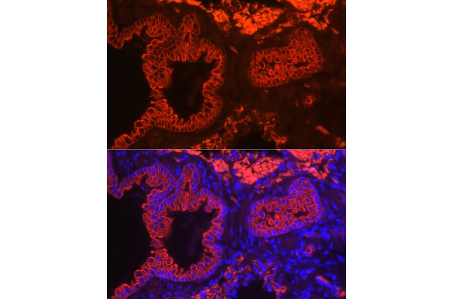 Immunofluorescence - Anti-Cytokeratin 7 Antibody [ARC0978] (A308287) - Antibodies.com