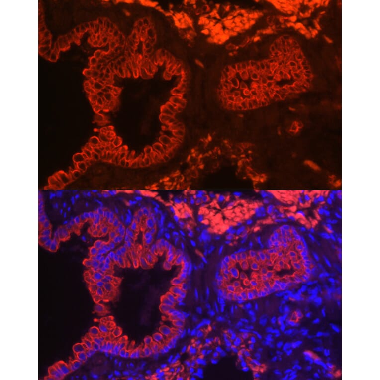 Immunofluorescence - Anti-Cytokeratin 7 Antibody [ARC0978] (A308287) - Antibodies.com