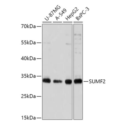 Western Blot - Anti-SUMF2 Antibody (A308288) - Antibodies.com