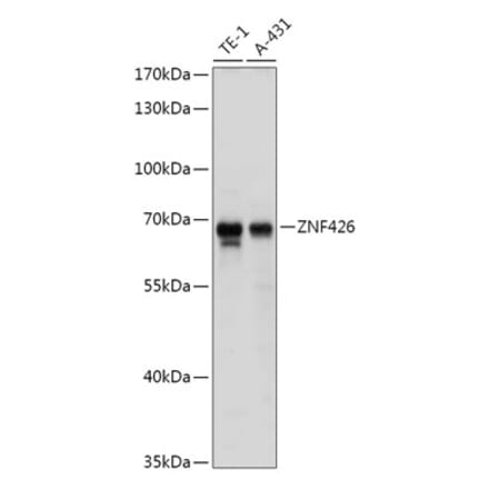 Western Blot - Anti-ZNF426 Antibody (A308289) - Antibodies.com