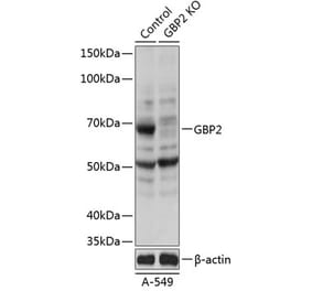 Western Blot - Anti-GBP2 Antibody (A308296) - Antibodies.com