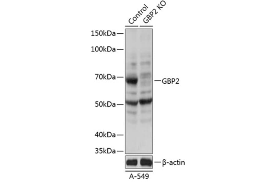 Western Blot - Anti-GBP2 Antibody (A308296) - Antibodies.com