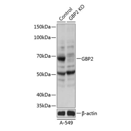 Western Blot - Anti-GBP2 Antibody (A308296) - Antibodies.com