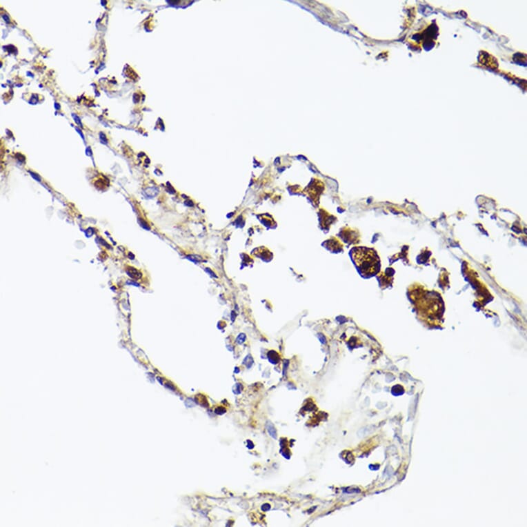 Immunohistochemistry - Anti-Ferritin Heavy Chain Antibody [ARC2665] (A308297) - Antibodies.com