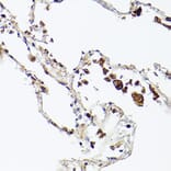 Immunohistochemistry - Anti-Ferritin Heavy Chain Antibody [ARC2665] (A308297) - Antibodies.com