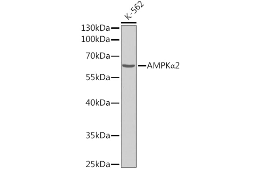 Western Blot - Anti-AMPK alpha 2 Antibody (A308298) - Antibodies.com