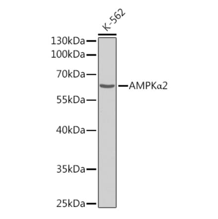 Western Blot - Anti-AMPK alpha 2 Antibody (A308298) - Antibodies.com