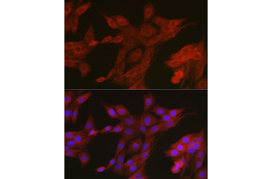 Immunofluorescence - Anti-AMPK alpha 2 Antibody (A308298) - Antibodies.com