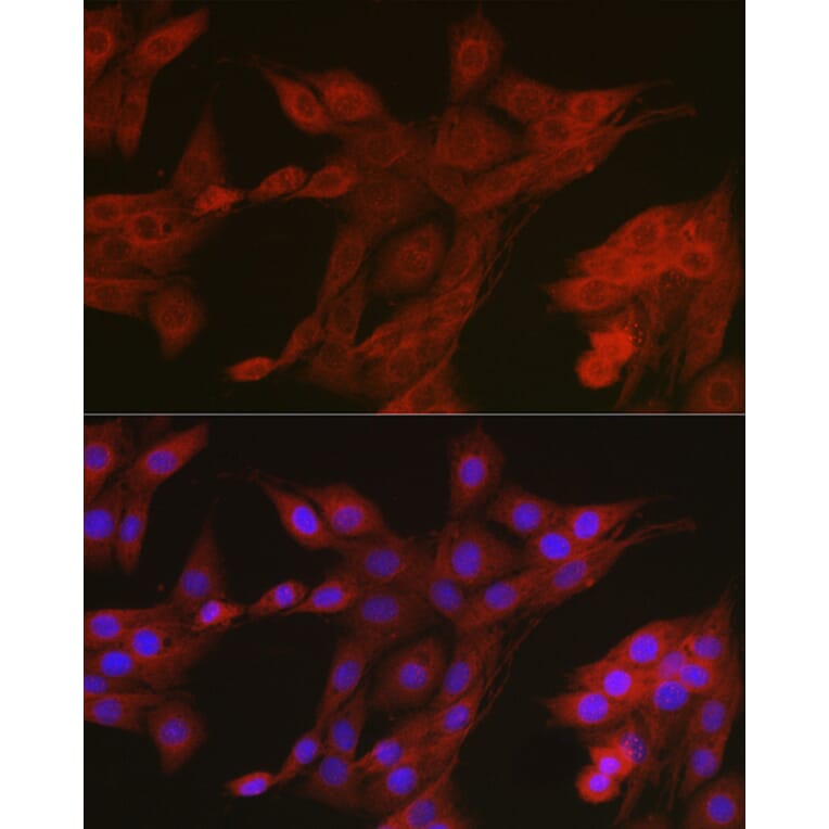 Immunofluorescence - Anti-AMPK alpha 2 Antibody (A308298) - Antibodies.com