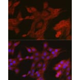 Immunofluorescence - Anti-AMPK alpha 2 Antibody (A308298) - Antibodies.com