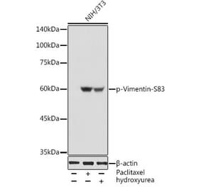 Western Blot - Anti-Vimentin (phospho Ser83) Antibody (A308301) - Antibodies.com
