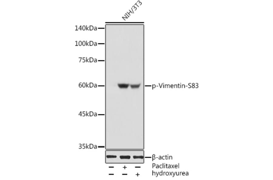 Western Blot - Anti-Vimentin (phospho Ser83) Antibody (A308301) - Antibodies.com