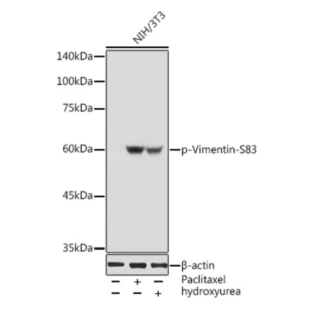 Western Blot - Anti-Vimentin (phospho Ser83) Antibody (A308301) - Antibodies.com