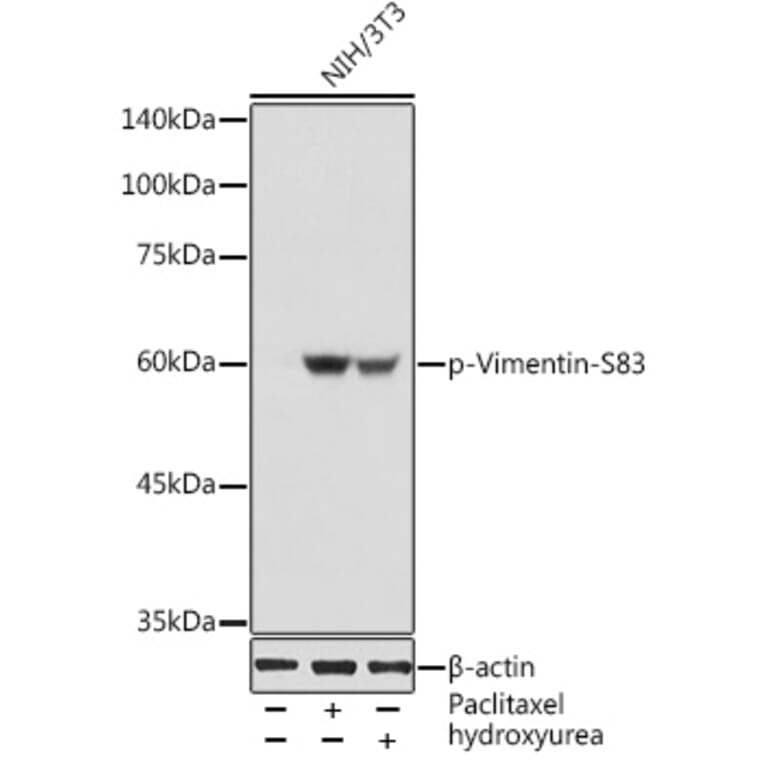 Western Blot - Anti-Vimentin (phospho Ser83) Antibody (A308301) - Antibodies.com