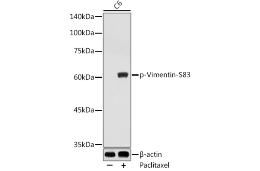 Western Blot - Anti-Vimentin (phospho Ser83) Antibody (A308301) - Antibodies.com
