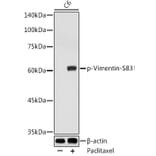 Western Blot - Anti-Vimentin (phospho Ser83) Antibody (A308301) - Antibodies.com