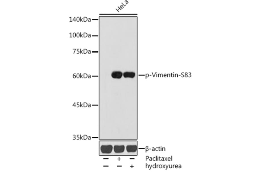 Western Blot - Anti-Vimentin (phospho Ser83) Antibody (A308301) - Antibodies.com