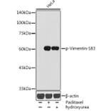 Western Blot - Anti-Vimentin (phospho Ser83) Antibody (A308301) - Antibodies.com