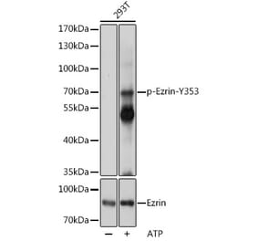 Western Blot - Anti-Ezrin (phospho Tyr353) Antibody (A308302) - Antibodies.com